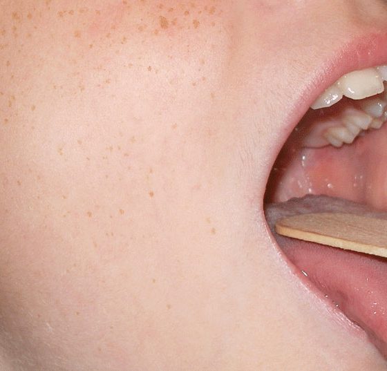 hals_kind_mandeln_stimme