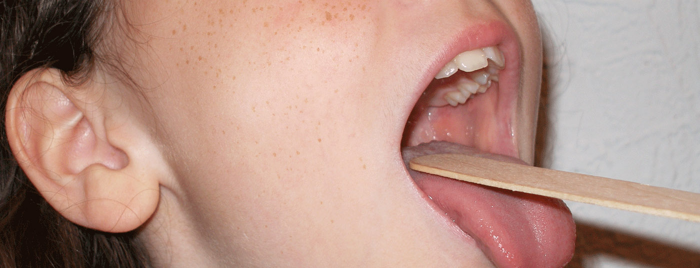 hals_kind_mandeln_stimme