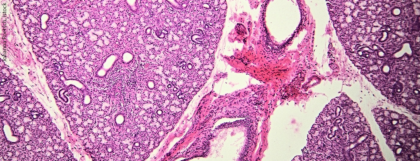 speicheldruese_istock-508860016