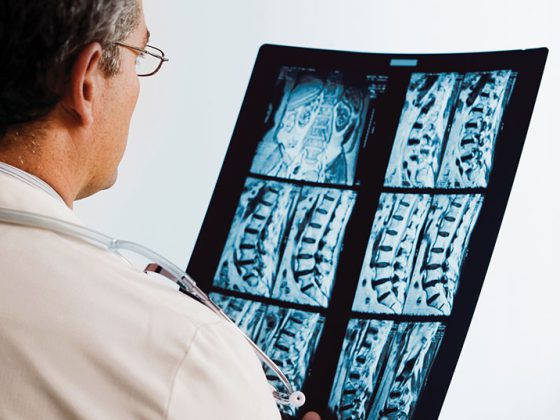 wirbelsaeule_arzt_istock-671053838