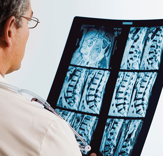 wirbelsaeule_arzt_istock-671053838