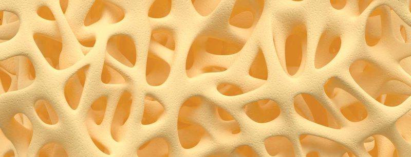 knochen_osteoporose