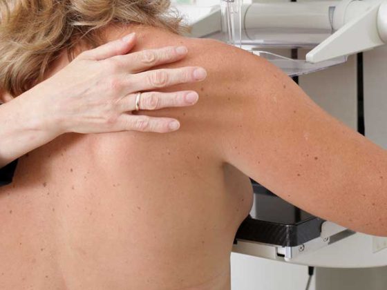 mammografie_brustkrebs