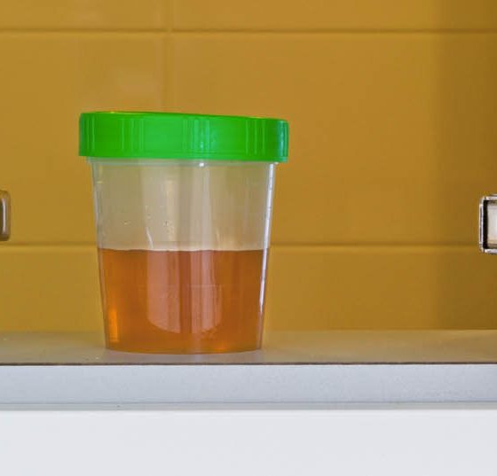 urin_harn_blase_urinprobe