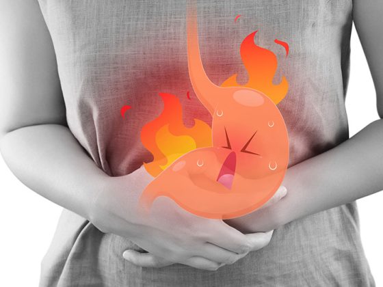 reflux_istock-896837100