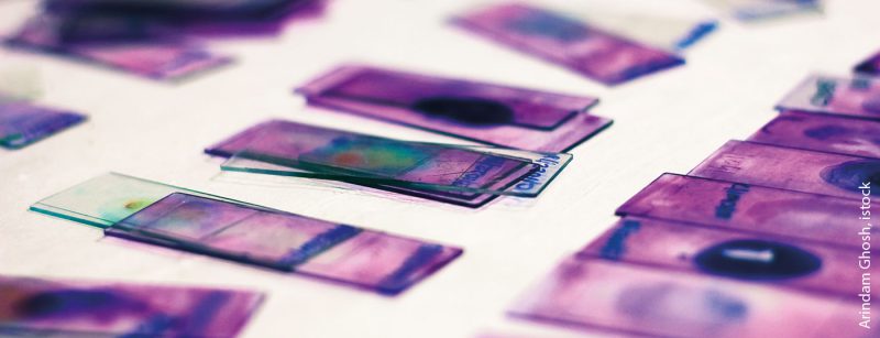 bluttest_istock-1007027768