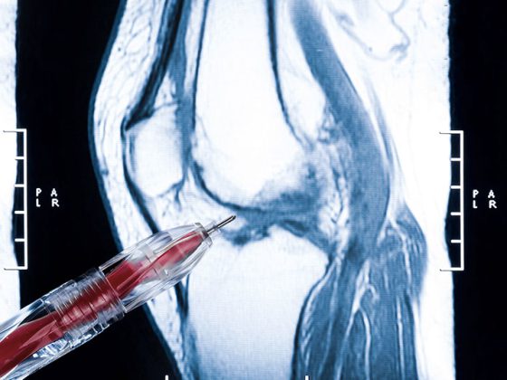 knie_istock-162258590