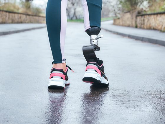 prothese_istock-1154019011