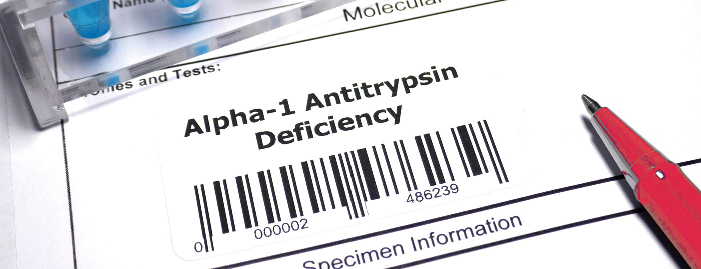 header-1043994508_rot