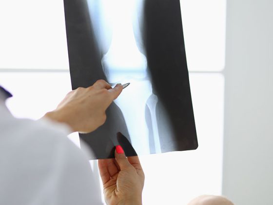 knie_istock-1286940824