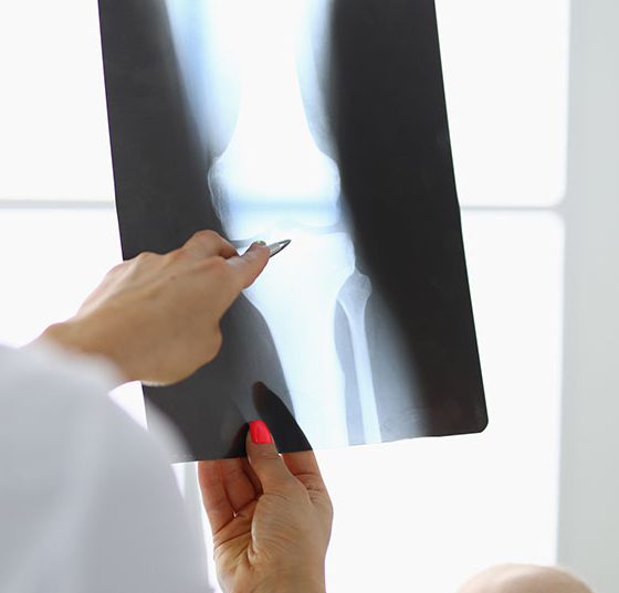 knie_istock-1286940824