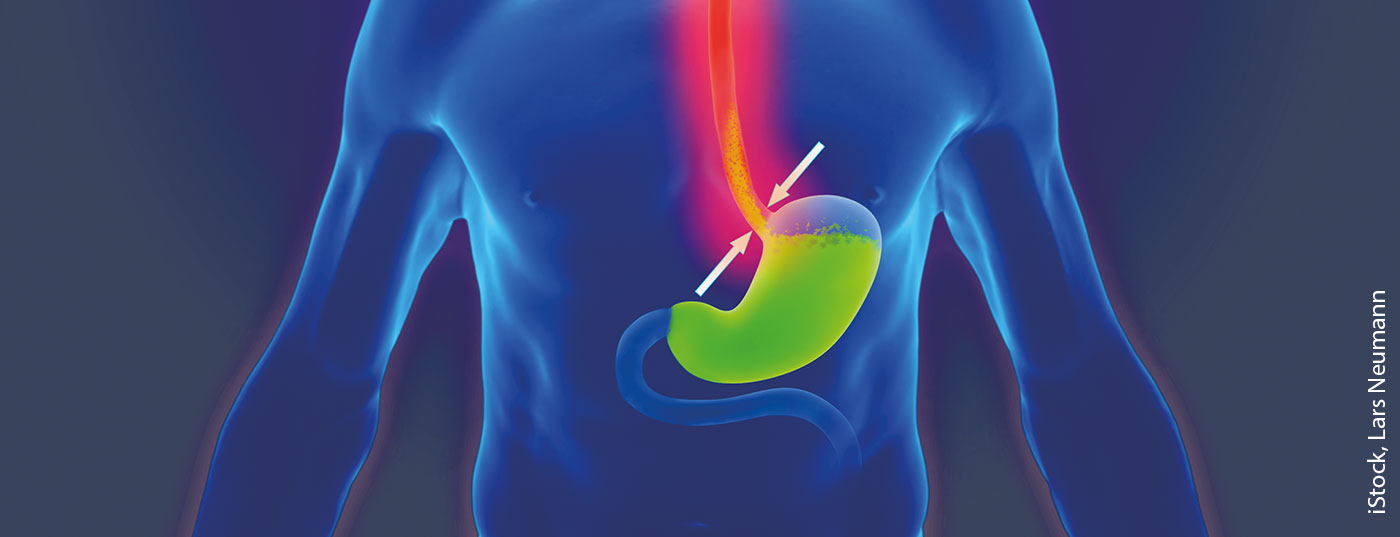 reflux