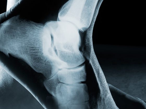 fuss_knoechel_istock-541847210