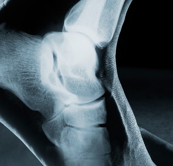 fuss_knoechel_istock-541847210