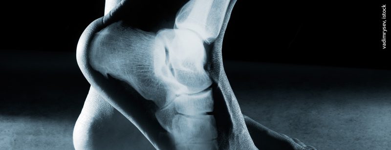 fuss_knoechel_istock-541847210