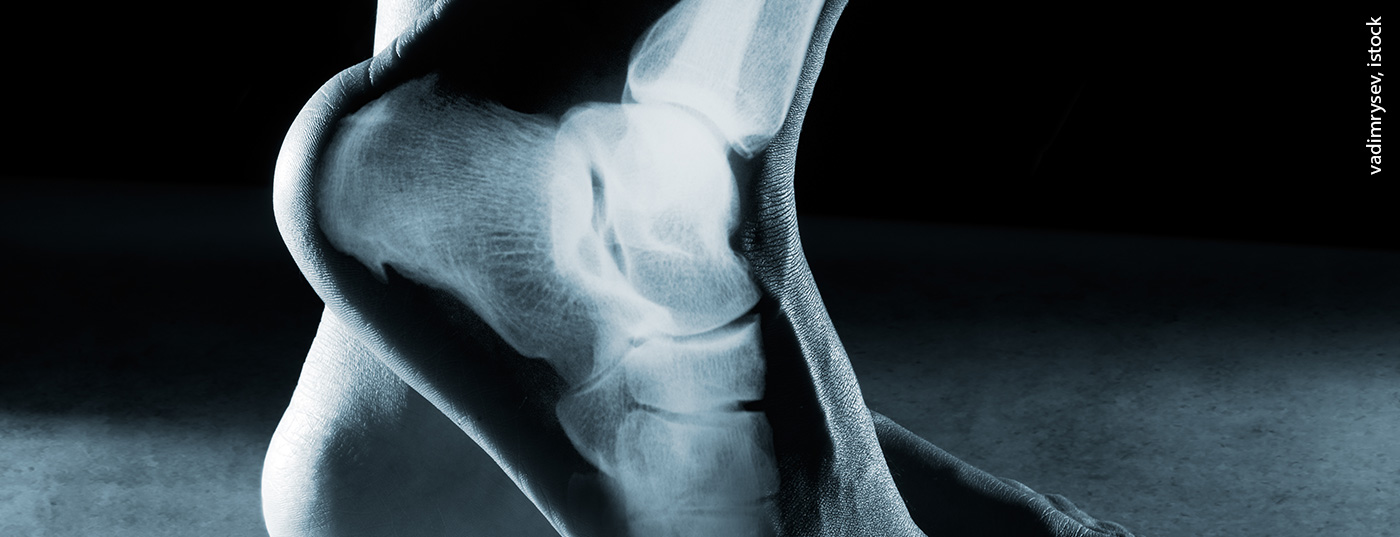 fuss_knoechel_istock-541847210