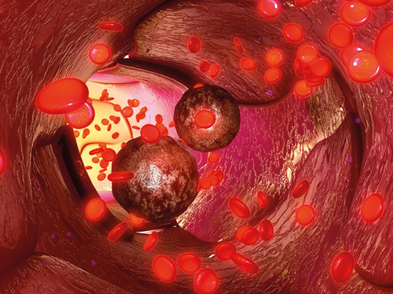 blut_istock-546466646