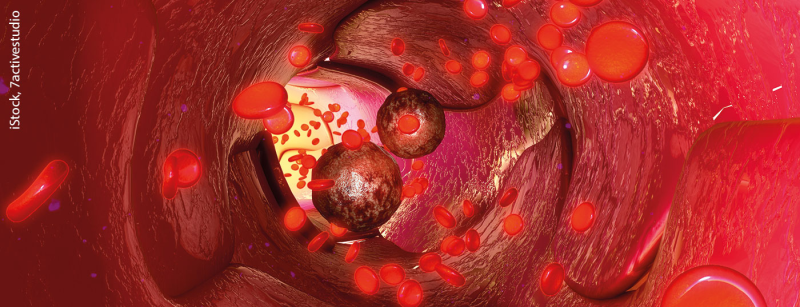 blut_istock-546466646