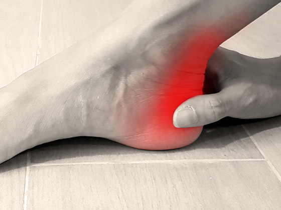 fuss_ferse_istock-1181999435