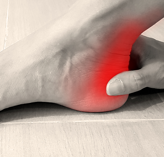 fuss_ferse_istock-1181999435