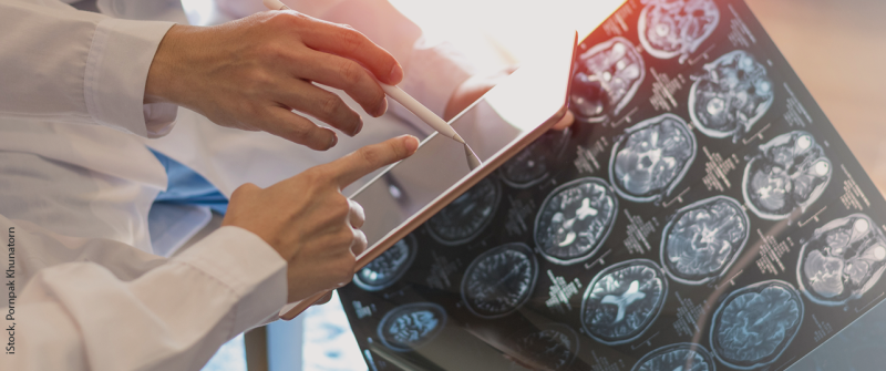 gehirn_neuro_istock-1194461946