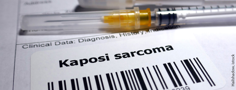 kaposi_istock-1128845466