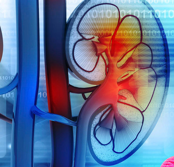 niere_78517227_head