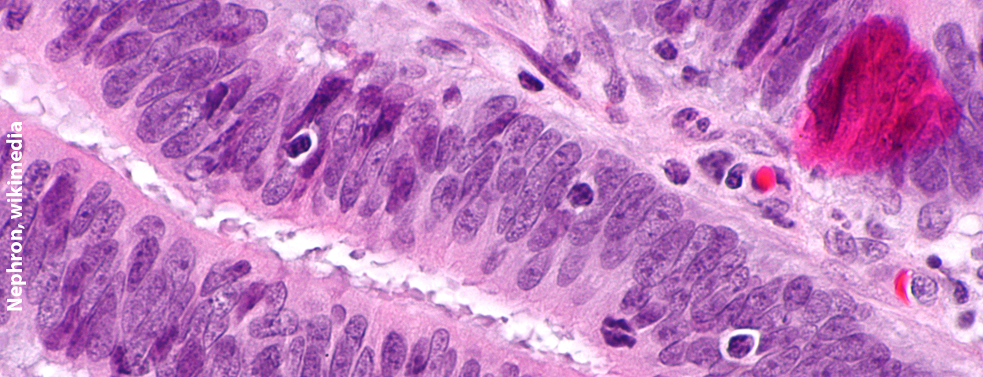 tumour-infiltrating_lymphocytes