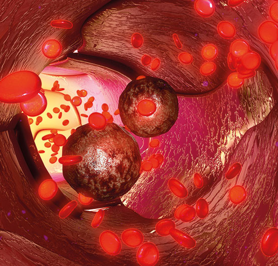 blut_istock-546466646