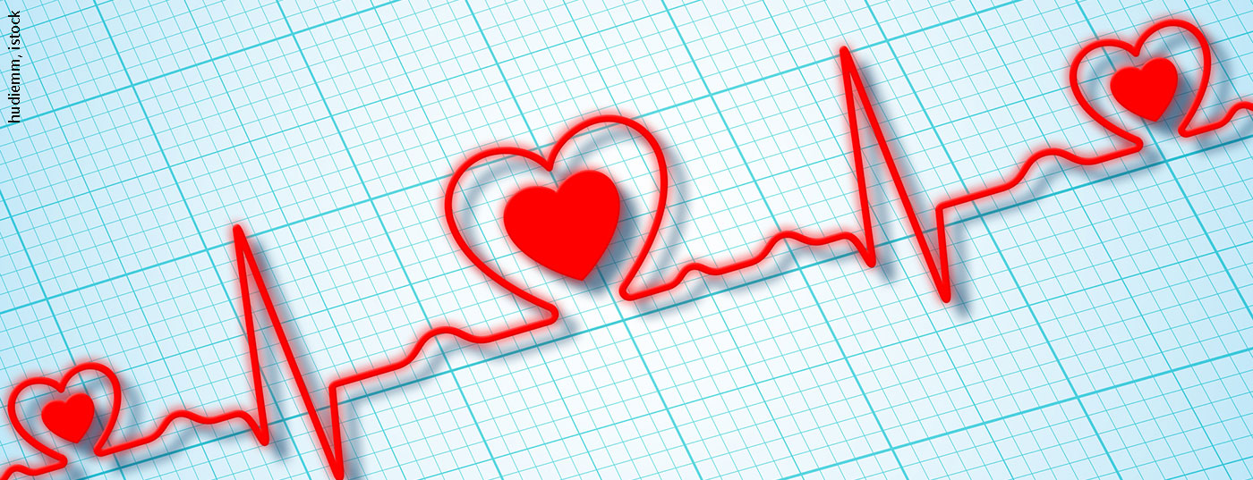 ekg_istock-1057080484
