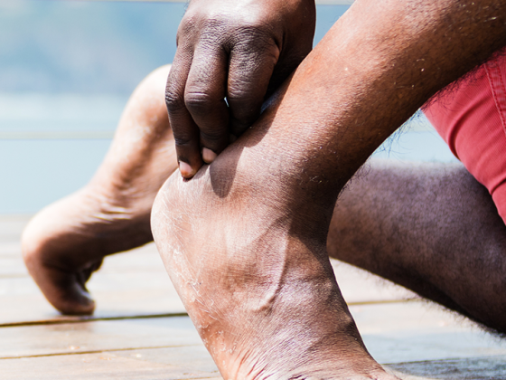 fuss_achillessehne_istock-1084996082