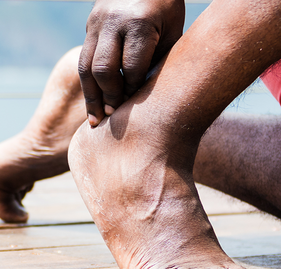 fuss_achillessehne_istock-1084996082