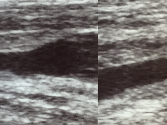 header_istock-1165063847