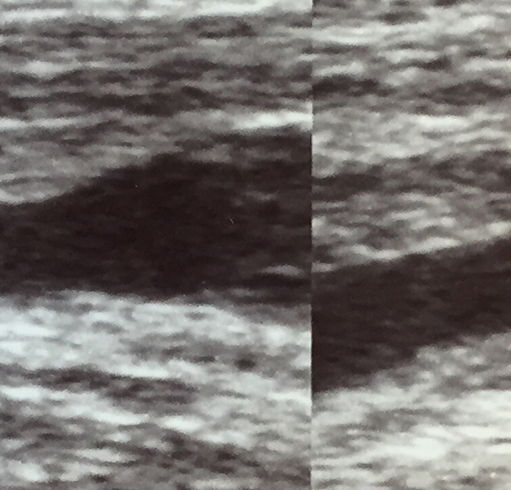 header_istock-1165063847