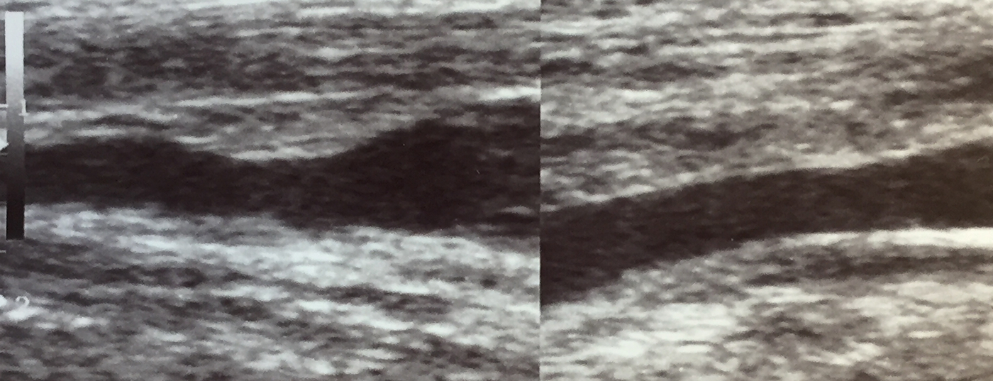 header_istock-1165063847