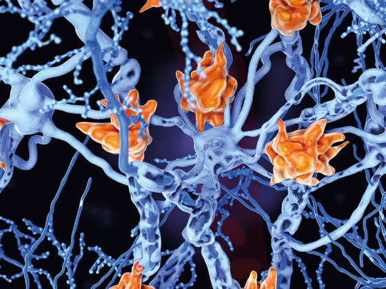 nerven_ms_istock-1141952174