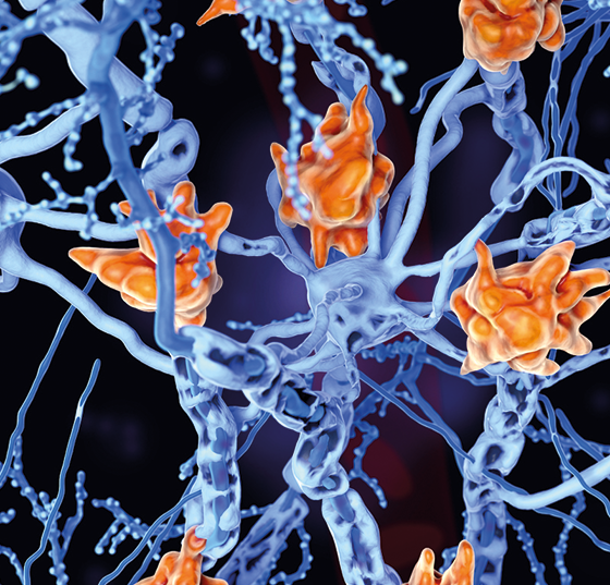 nerven_ms_istock-1141952174