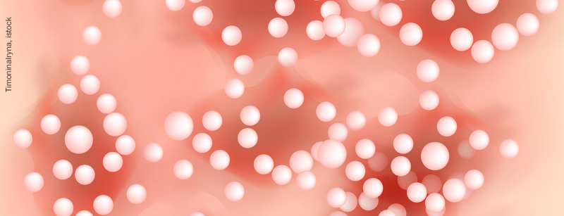 psoriasis-pustulosa_istock-1125250819