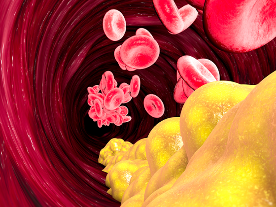 cholesterin_istock-943524244