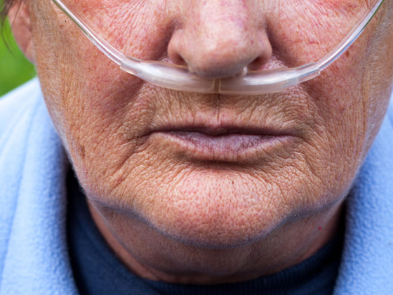 copd_istock-522695539