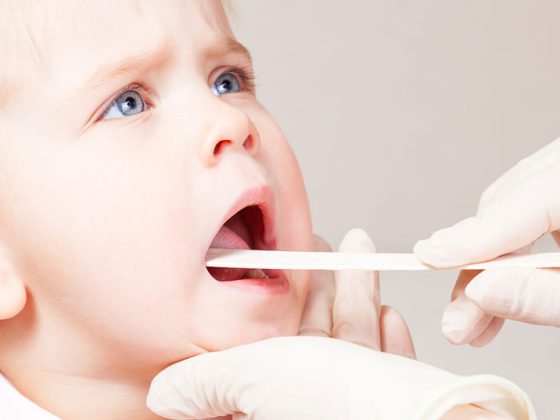 angina_kind_halsweh_istock-629568594