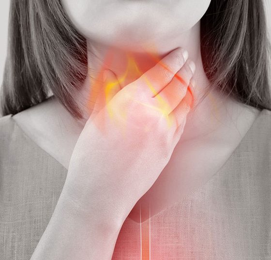 reflux_istock-880723156