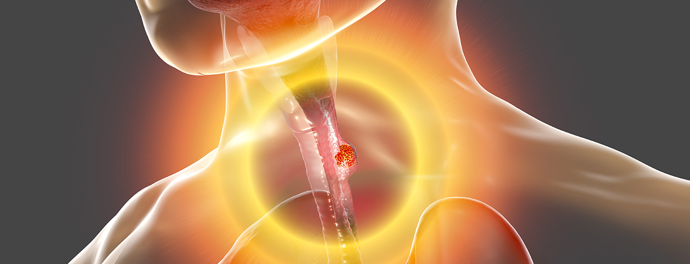 istock-1166055907-2