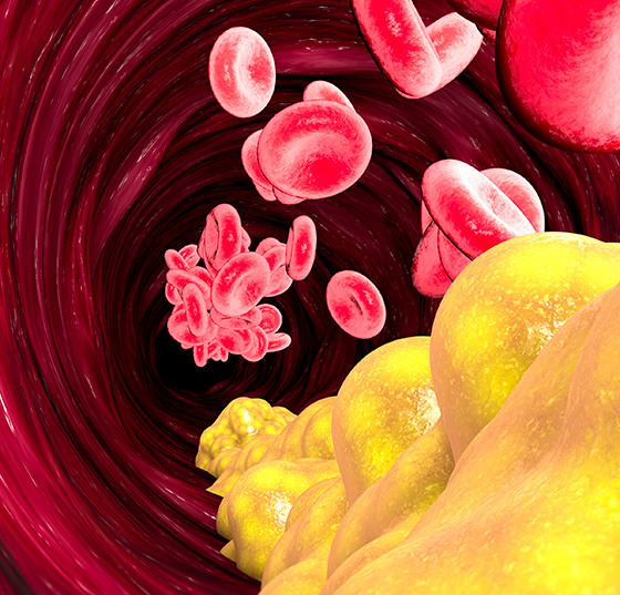 cholesterin_istock-943524244