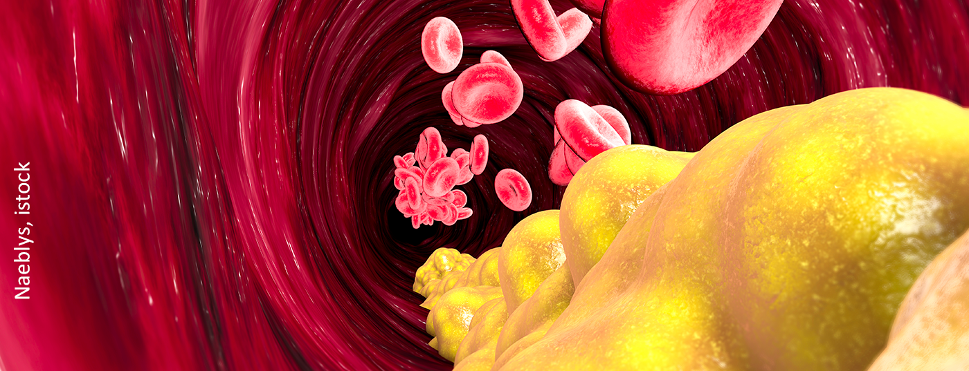 cholesterin_istock-943524244