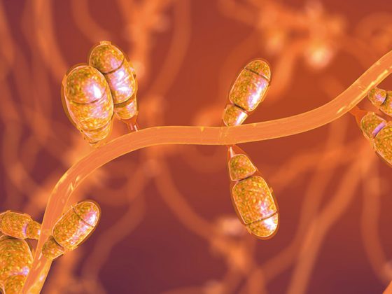 hautpilz_istock-1266817563