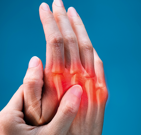 psoriasis-arthritis_istock-1165109879