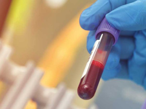 blutprobe_istock-1164063949