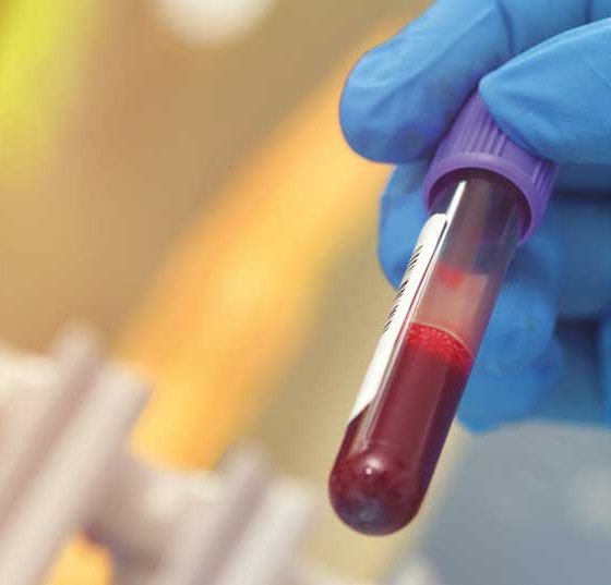 blutprobe_istock-1164063949