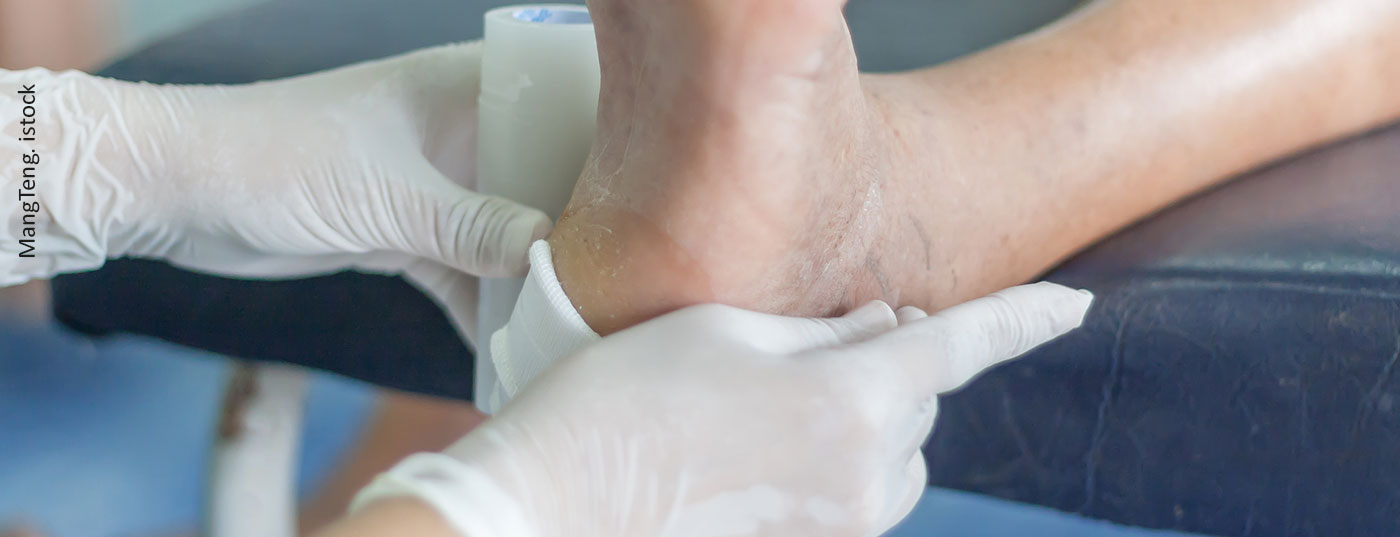 fuss_diabetes_wunde_istock-823680582